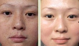 徒手祛斑爆料视频大全集,视频大全集深度解析